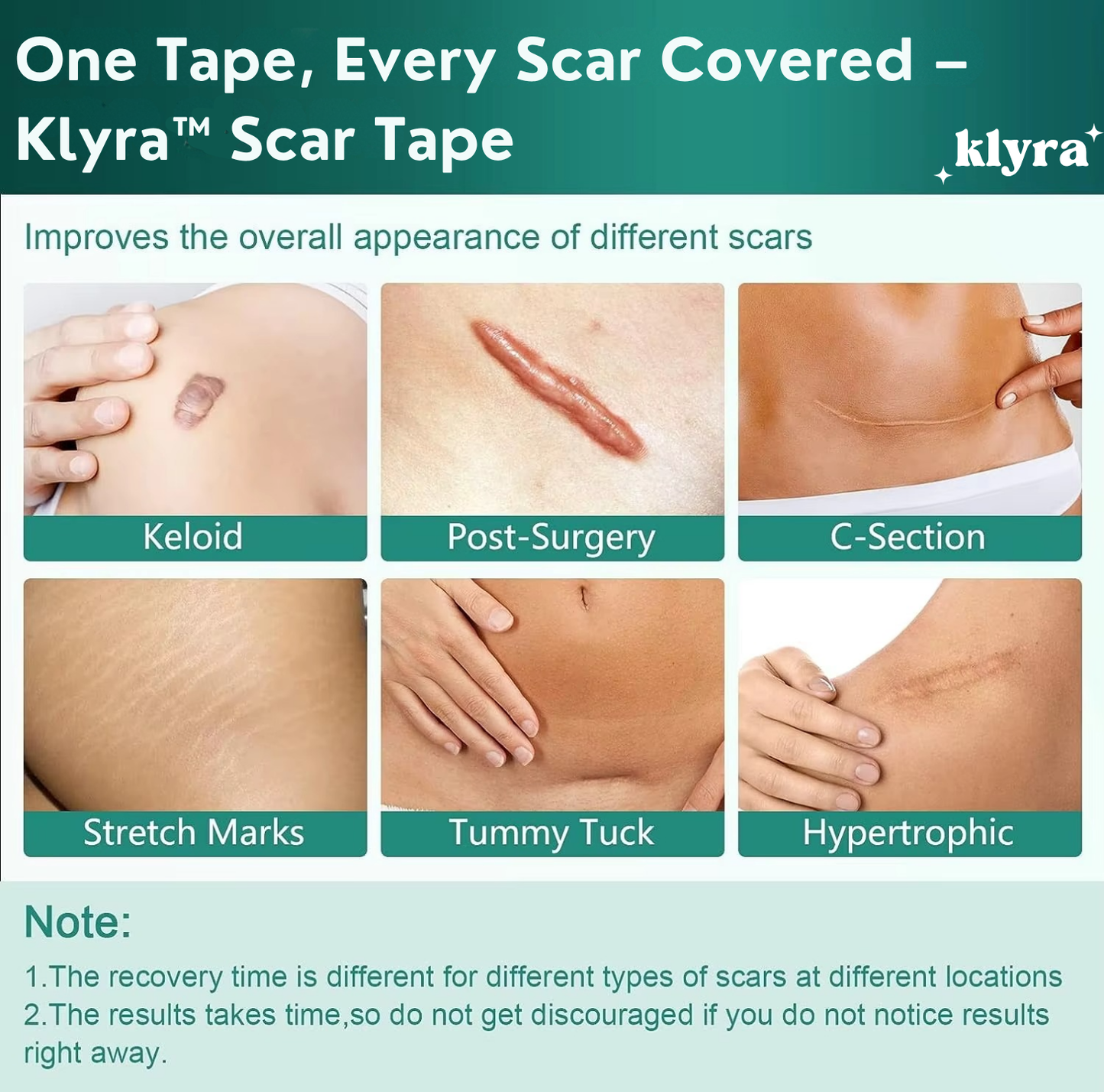 Klyra™ Scar Tape