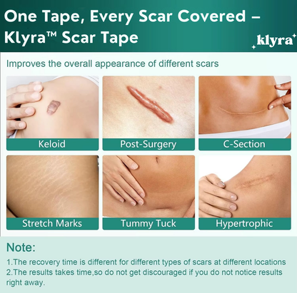 Klyra™ Scar Tape