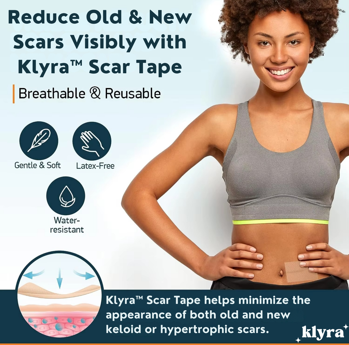 Klyra™ Scar Tape